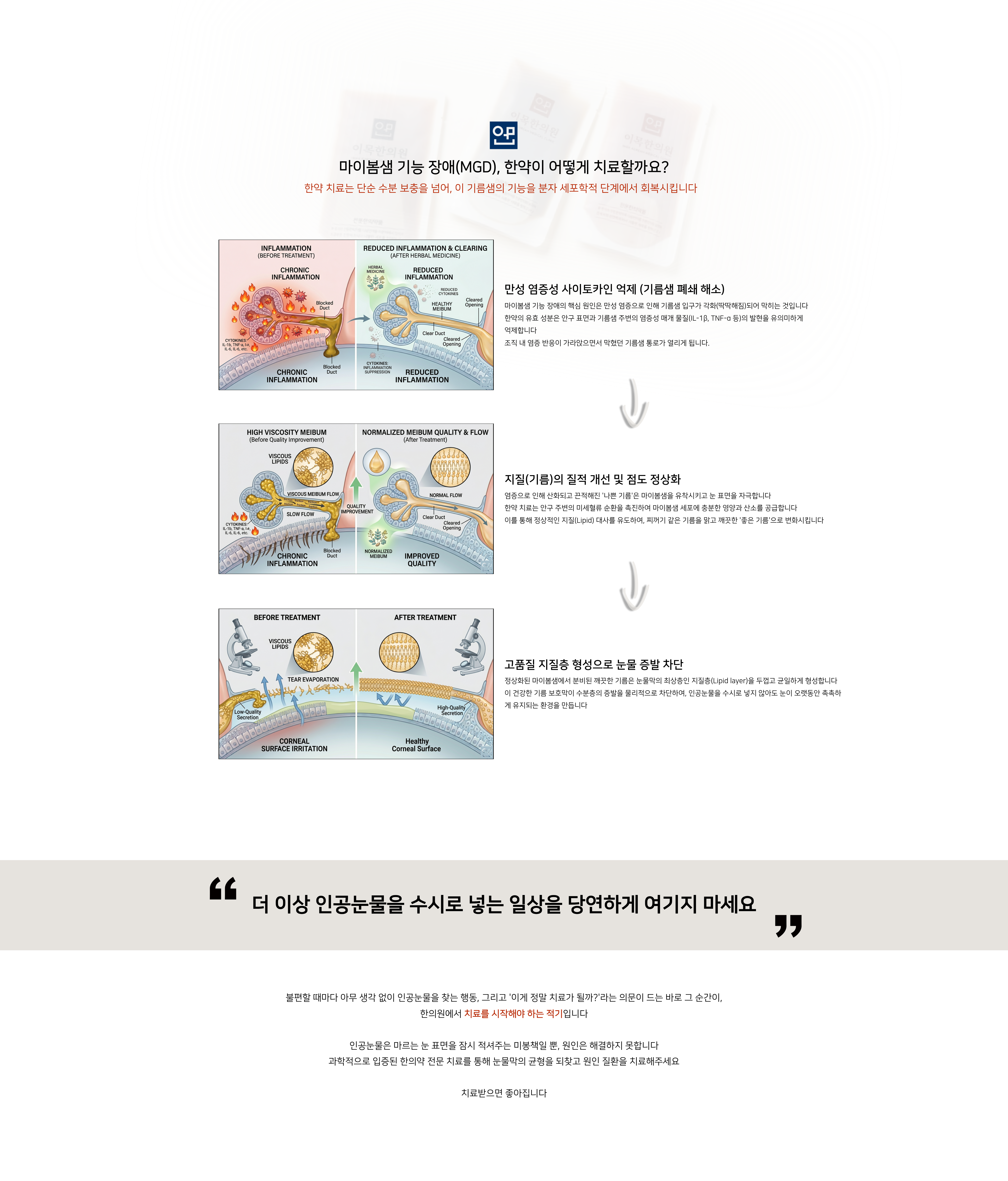이목한의원 눈클리닉 2